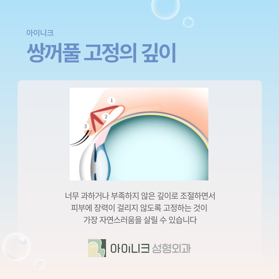 쌍꺼풀성형외과 흉터가 남을까 걱정된다면? 관련 이미지 10