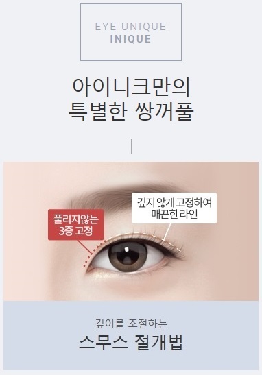 쌍수절개법 특별한 노하우 공개 관련 이미지 2