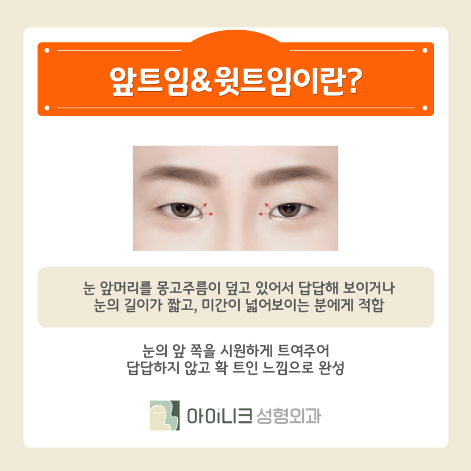 눈꼬리올리기 또렷하고 자연스러운 눈으로 관련 이미지 9