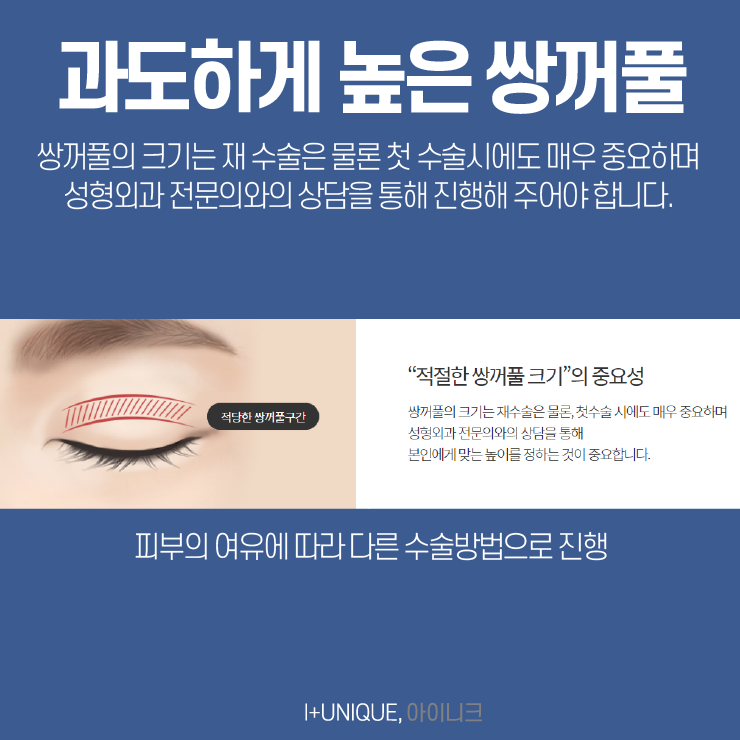 소세지쌍꺼풀이 고민이라면 아이니크성형외과를 오면 답이 있다 관련 이미지 3