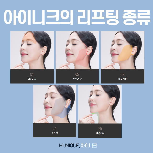 유지기간부터 회복기간까지 완벽한 안면거상술 관련 이미지 2