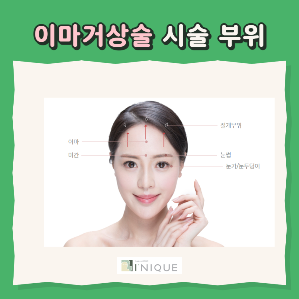 처진눈수술방법으로 또렷한 인상 만들기 관련 이미지 2