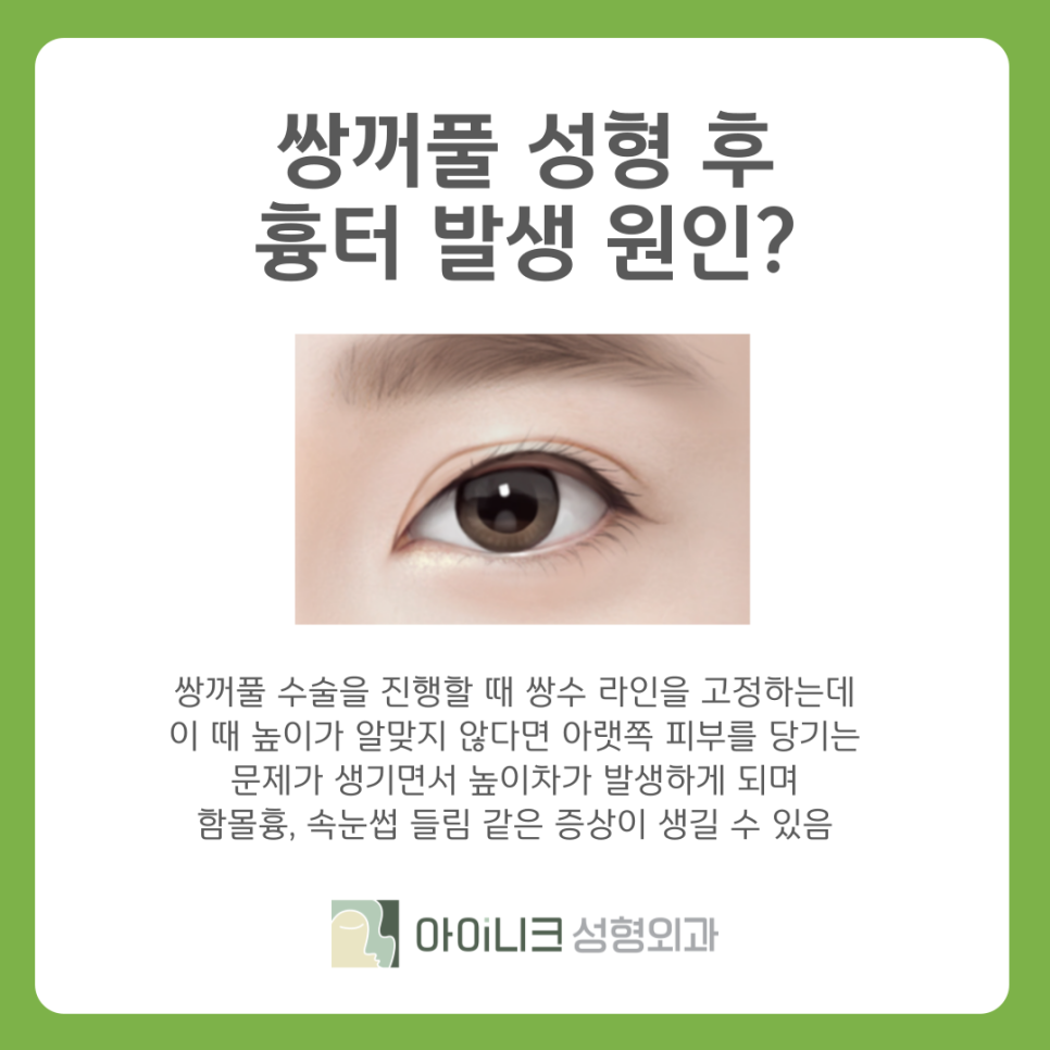 쌍꺼풀흉터 재수술 추천 원인과 해결방법 관련 이미지 5