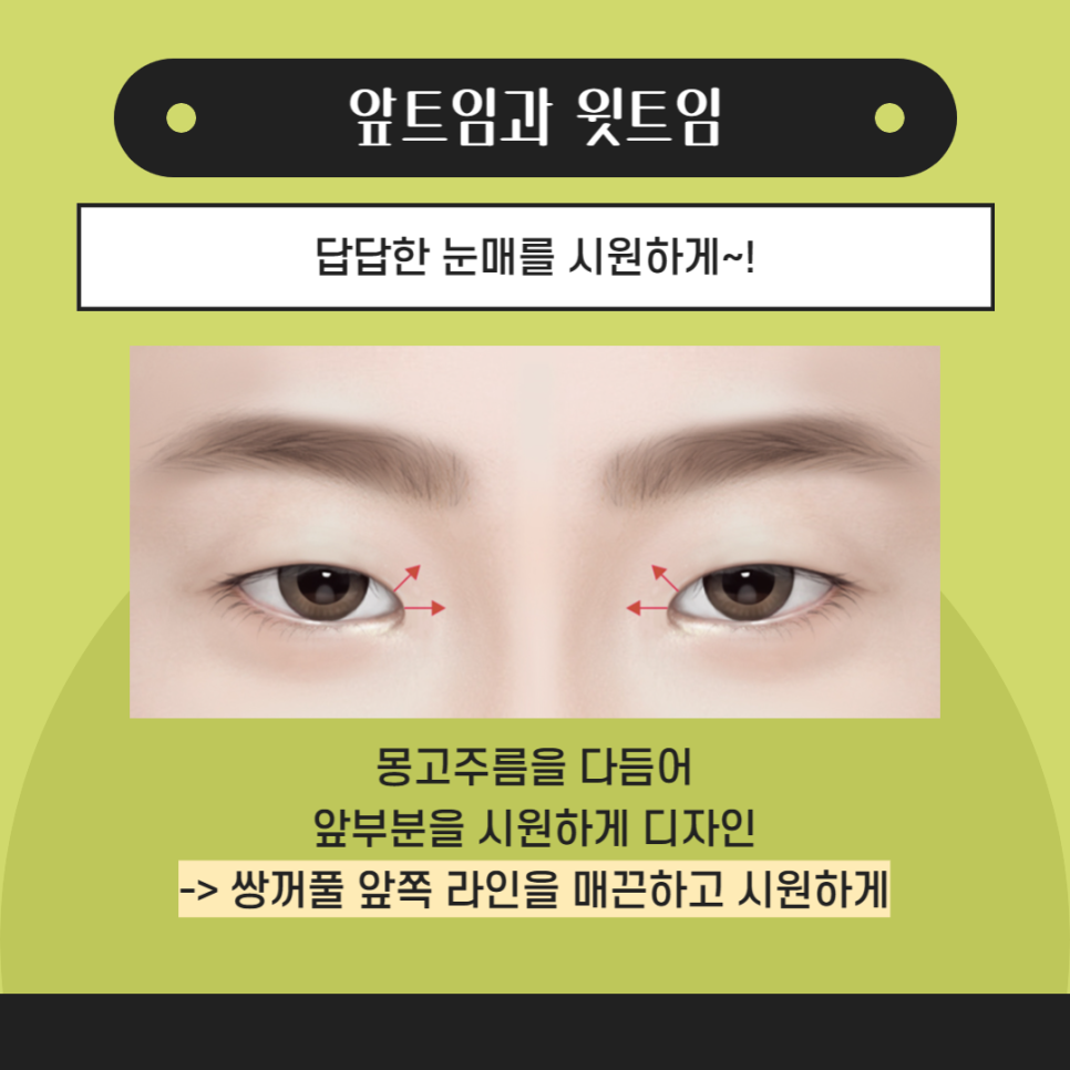 강남앞트임 주저말고 아이니크로! 관련 이미지 4