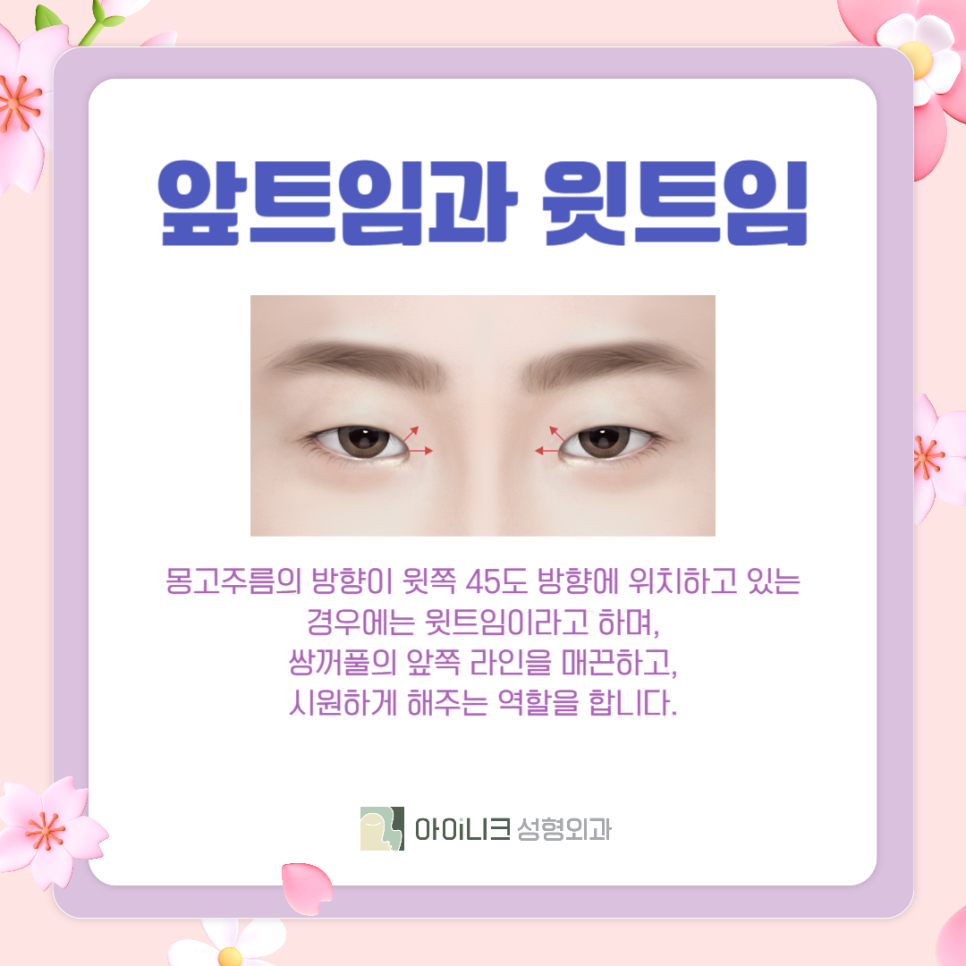 The Best Place for Women’s Eye Surgery Is Where I Had It Done image 3