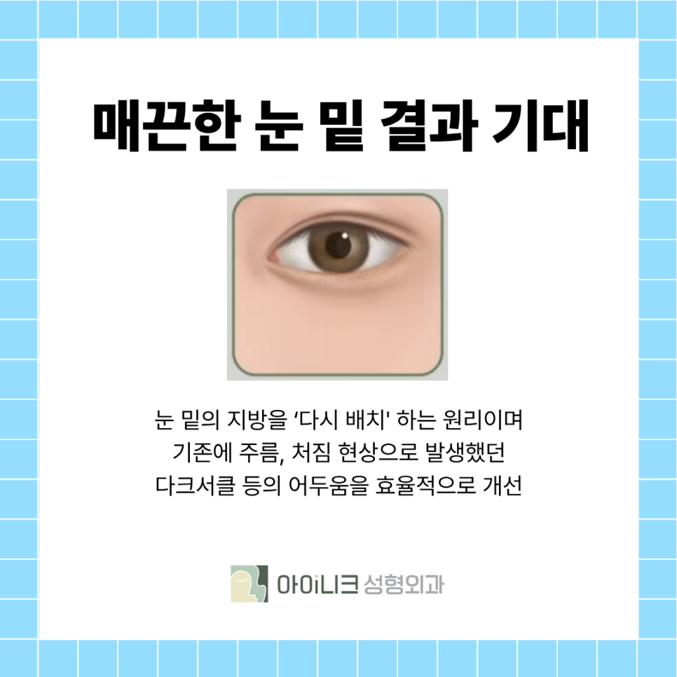 What Is the Most Efficient Way to Get Rid of Under-Eye Wrinkles? image 11