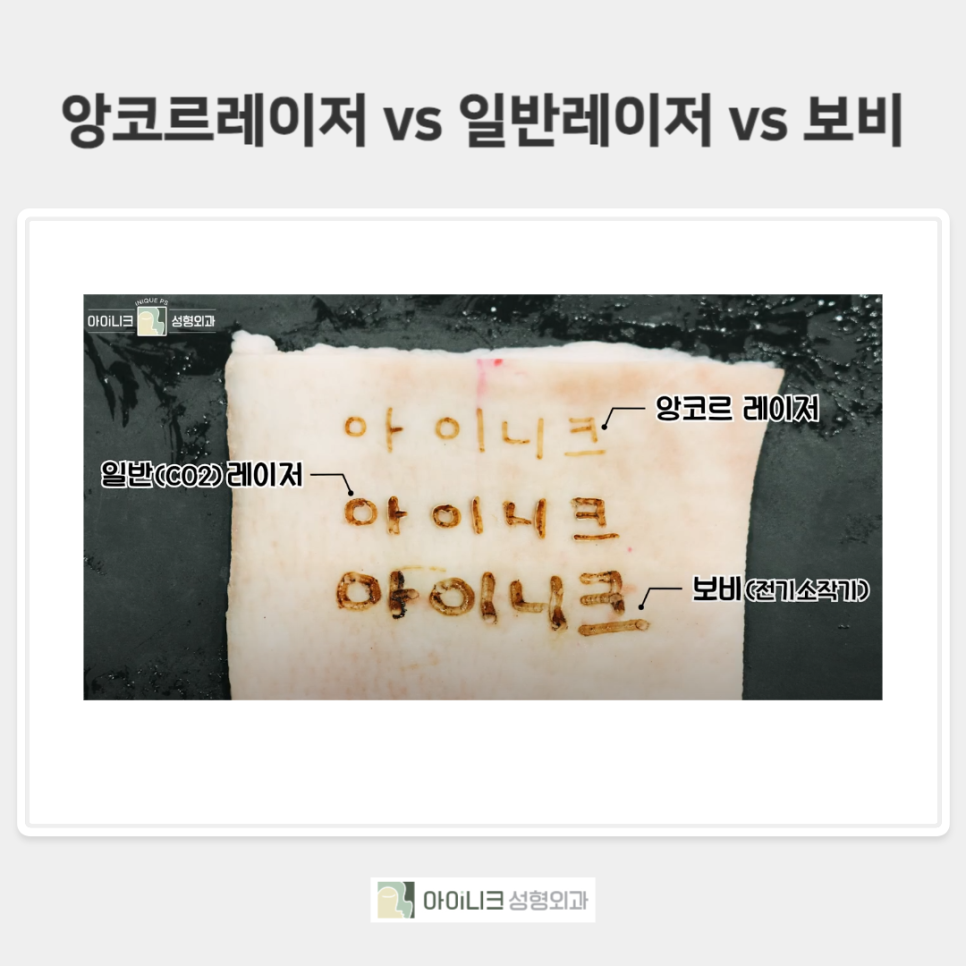 앙코르 눈밑지방재배치 알아보기! 관련 이미지 3