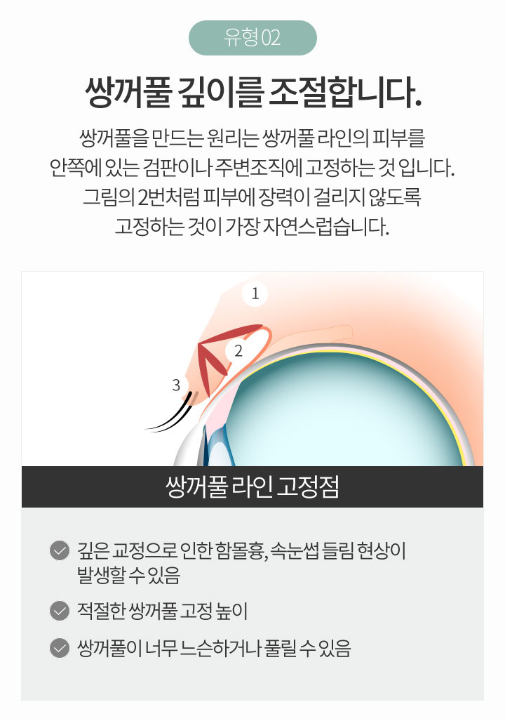 속눈썹들림 더 이상 고민하지 마세요! 관련 이미지 4