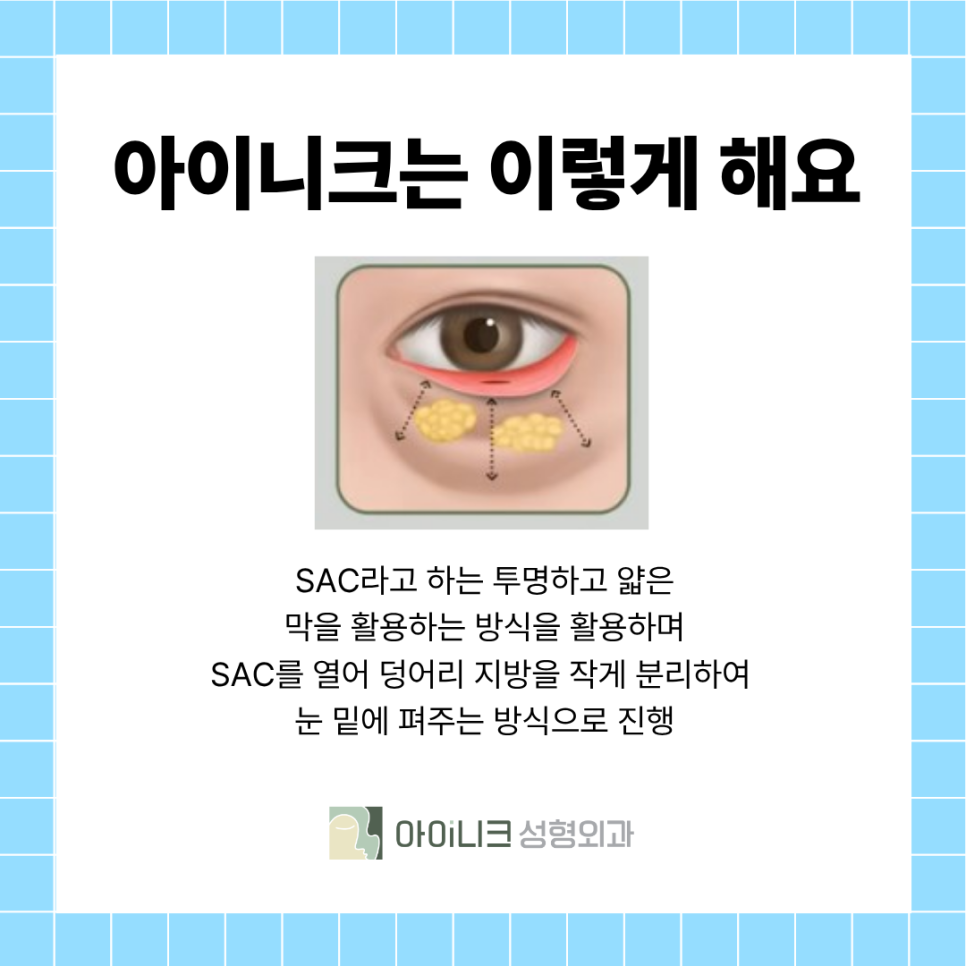 What Is the Most Efficient Way to Get Rid of Under-Eye Wrinkles? image 9