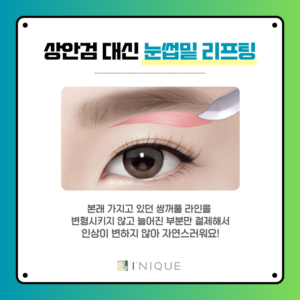청담동 중년눈성형 정보! 상안검 비추하는 이유 관련 이미지 5
