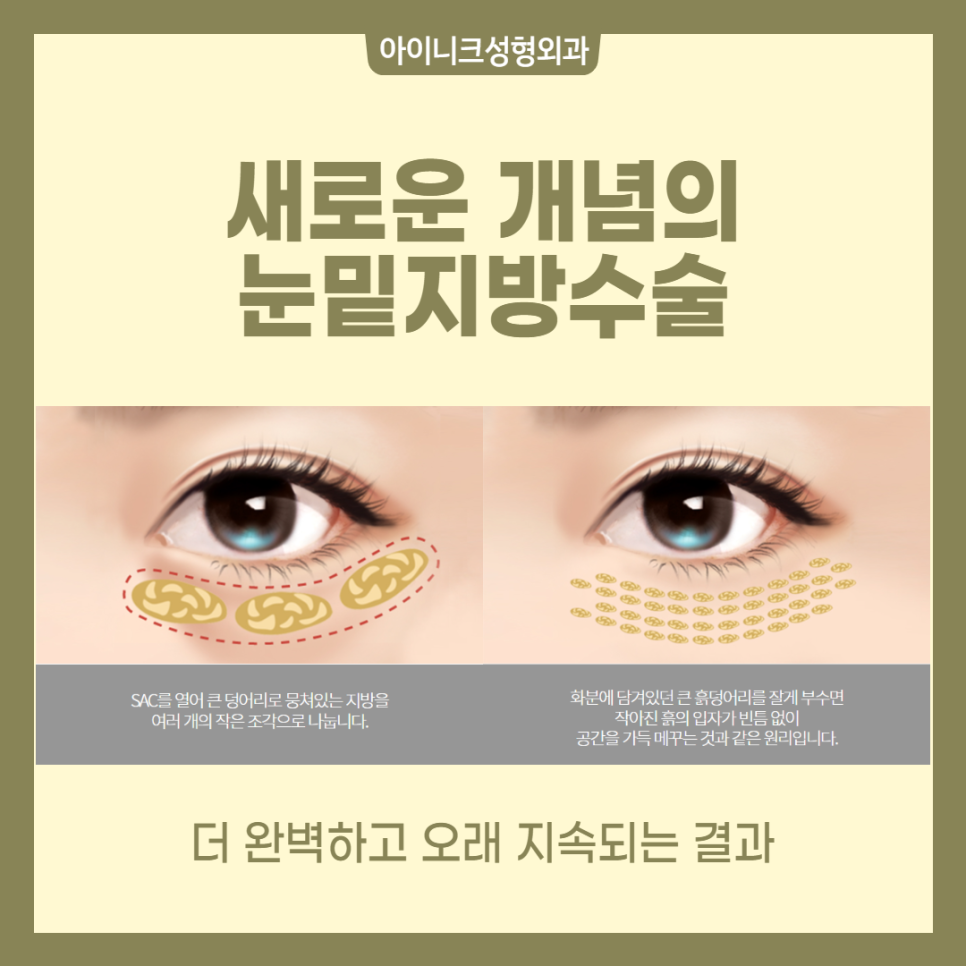 A New Concept in Under-Eye Surgery Center, Inique! image 2