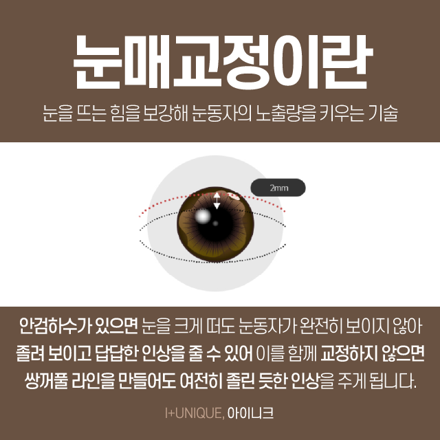 남자쌍꺼풀병원추천 고민하지 말자! 관련 이미지 4