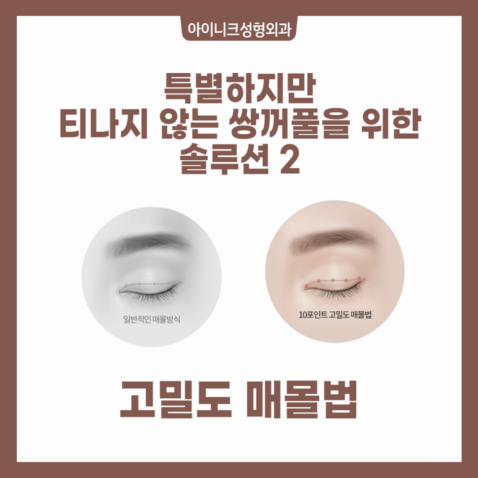 성형외과 발품 팔기? 강남쌍수병원 아이니크가 정답 관련 이미지 4