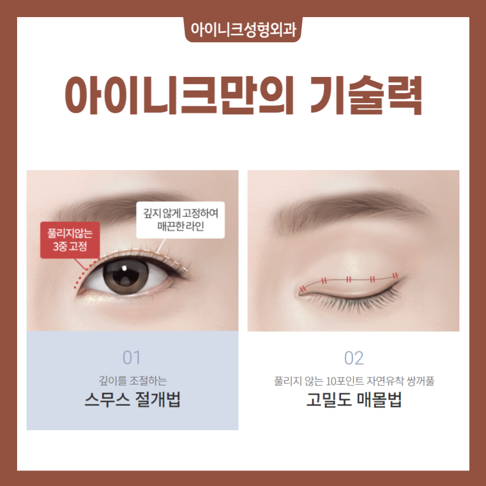 자연스러운눈성형 원한다면 미리 알아야 할 사실 관련 이미지 5