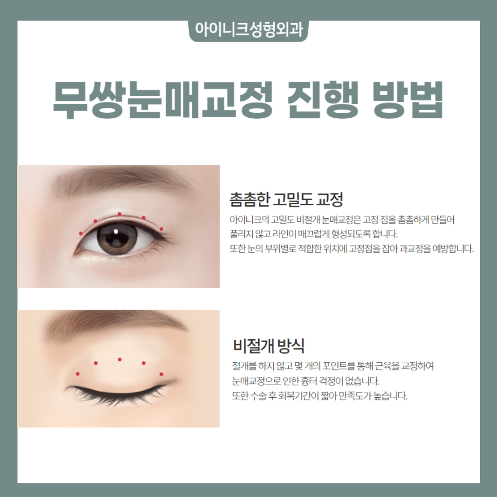 Get Your Blepharoplasty Consultation Done Properly! image 6
