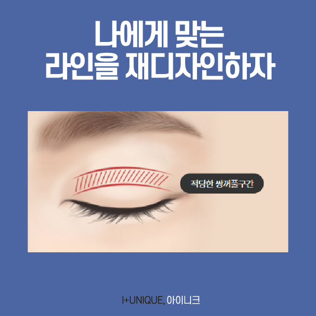 Must-Read: How to Avoid Failed Double Eyelid Revision Surgery image 3