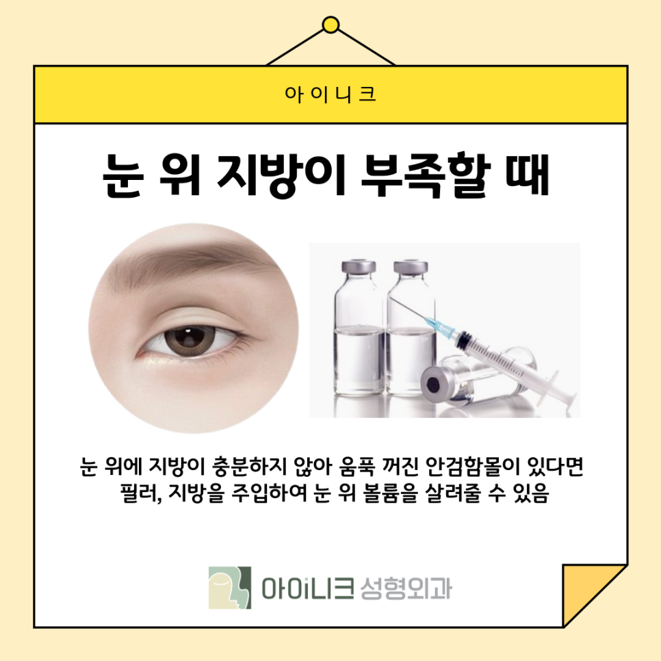 How Can Sausage-Eye Revision Surgery Be Done Naturally? image 10