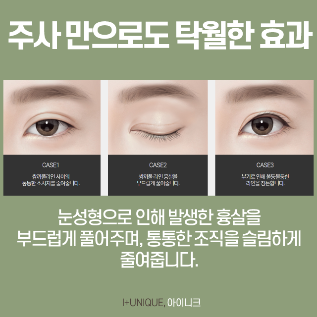 소시지눈주사로 간단하게 해결! 관련 이미지 5