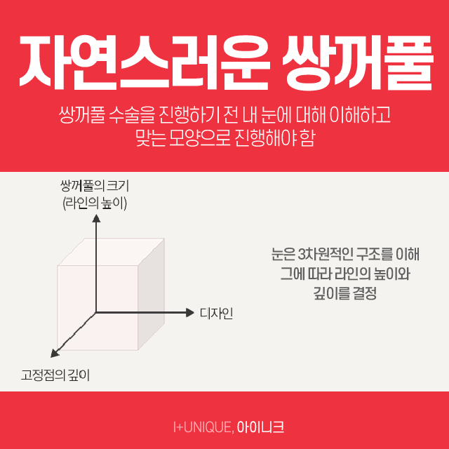쌍수병원추천 수술의 종류를 알면 실력이 보인다! 관련 이미지 2