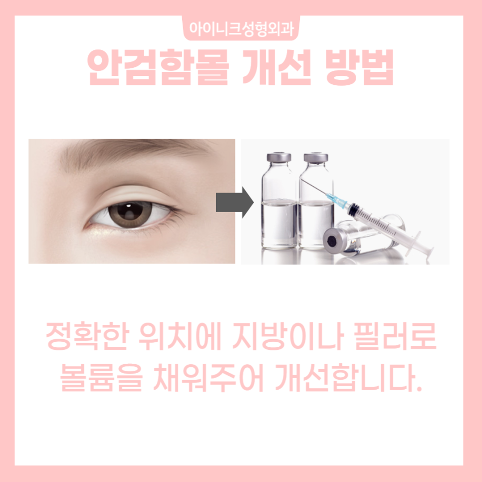 If You’re Curious About How to Succeed with Revision Surgery for a “Sausage Eye” image 5