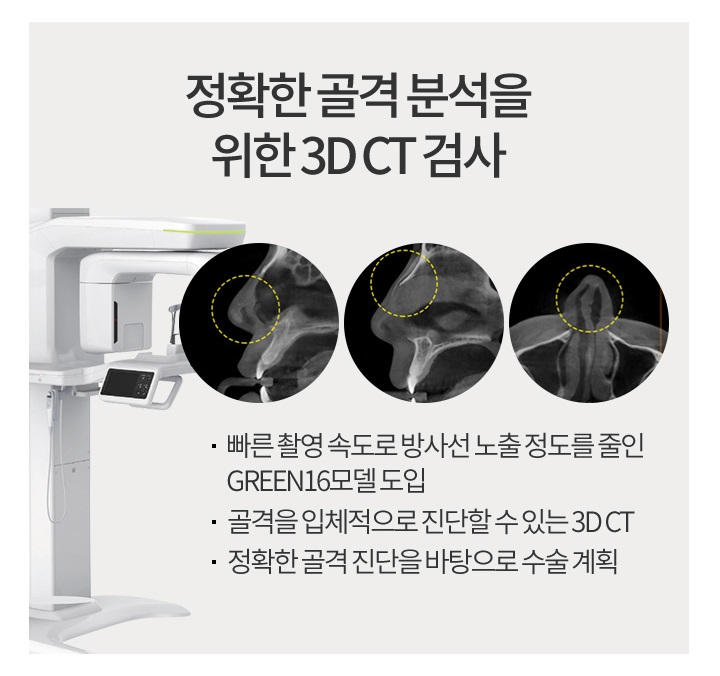 주먹코수술 콧볼축소로 완성하자! 관련 이미지 5