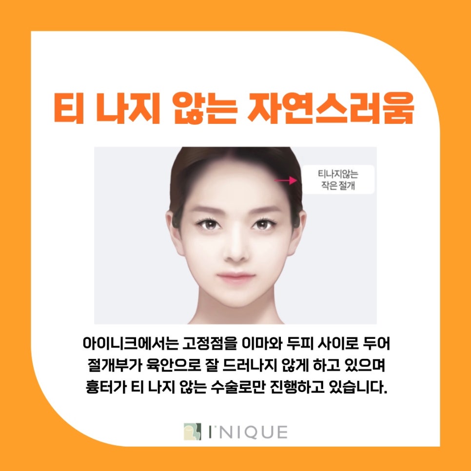 How to Keep a Brow Lift Looking Natural for a Long Time image 4