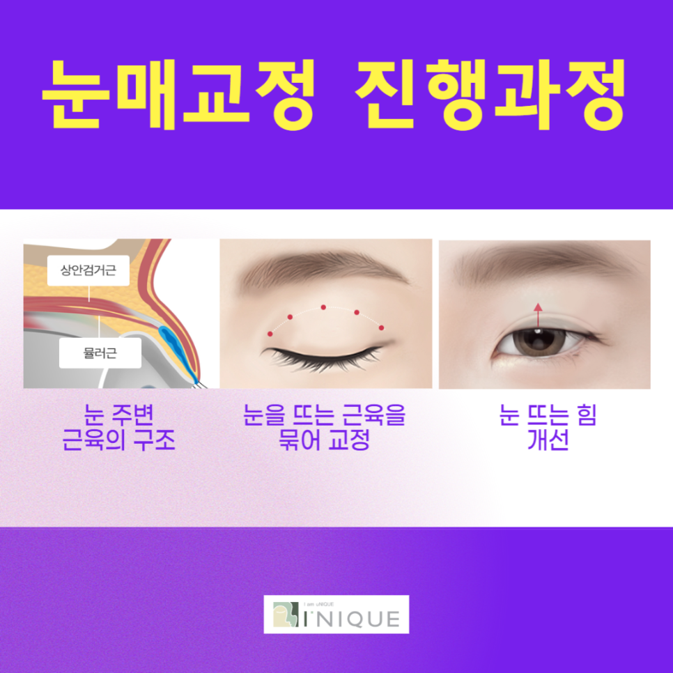 Drooping Eyelids, Starting from the Root Cause image 4