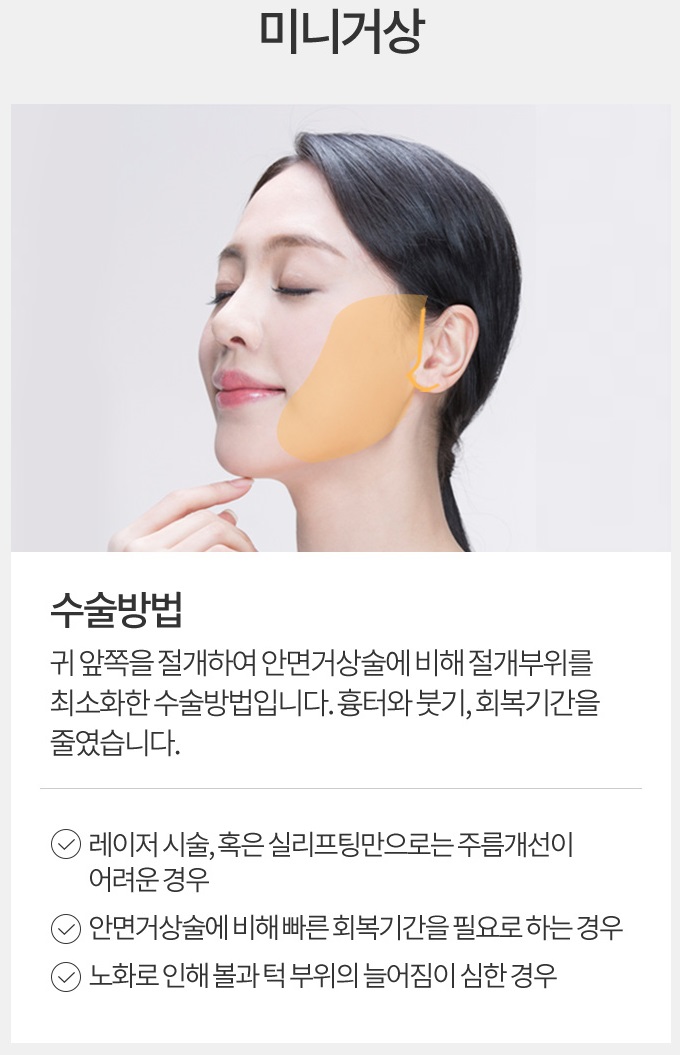 최소절개리프팅 받고 젊어지자! 관련 이미지 5