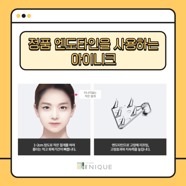 중년안면거상, 안전하게 하려면 관련 이미지 3