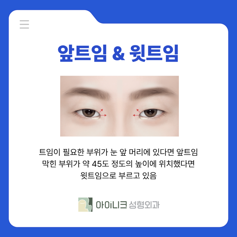 남자눈수술 앞트임으로 또렷하고 남성스럽게 관련 이미지 5