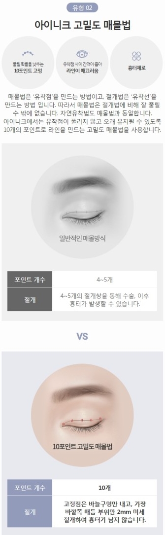 연예인쌍커풀 같은 자연스럽고 또렷한 눈매를 원한다면! 관련 이미지 5
