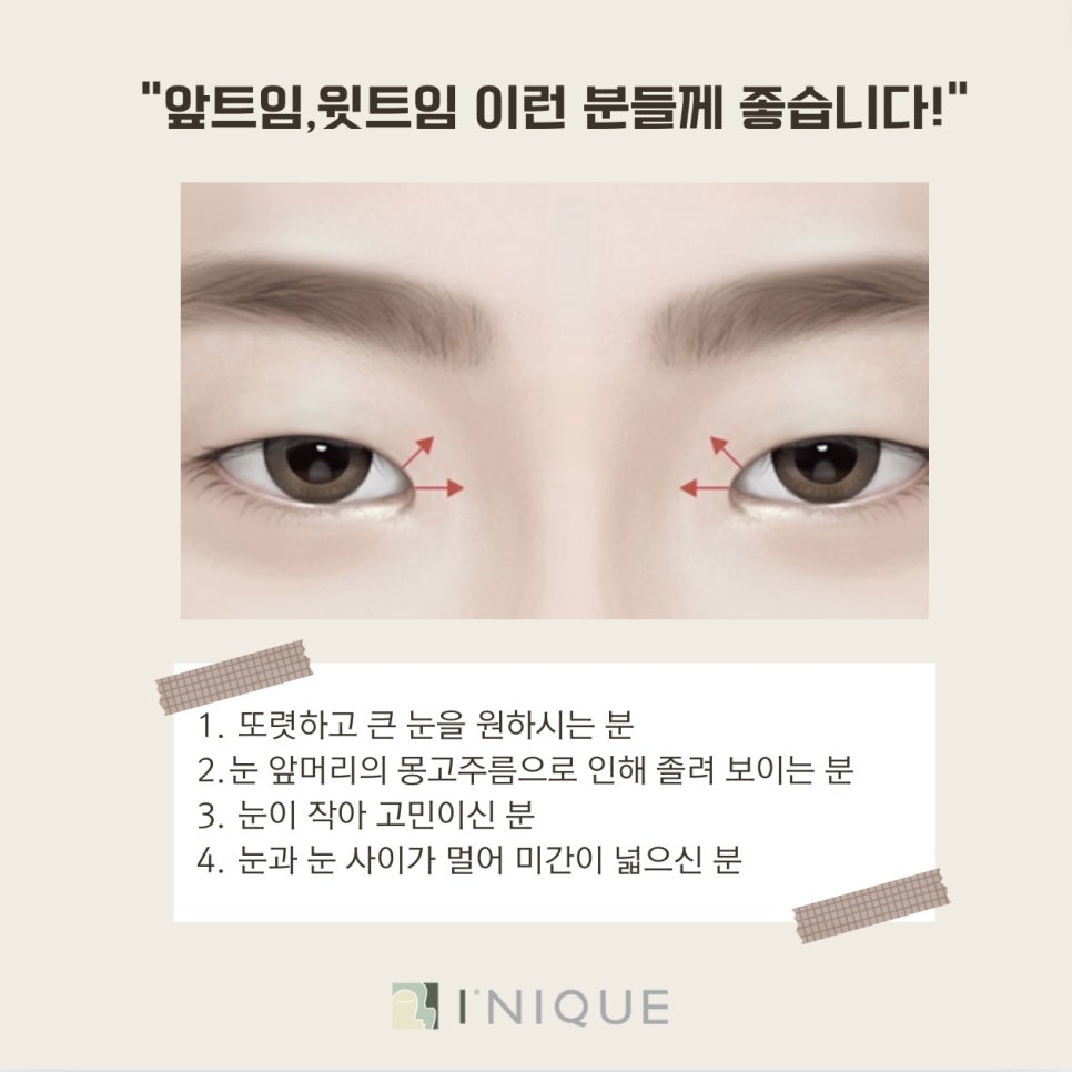 Inner Corner Eye Surgery Recommendation: Who Is It Suitable For? image 4