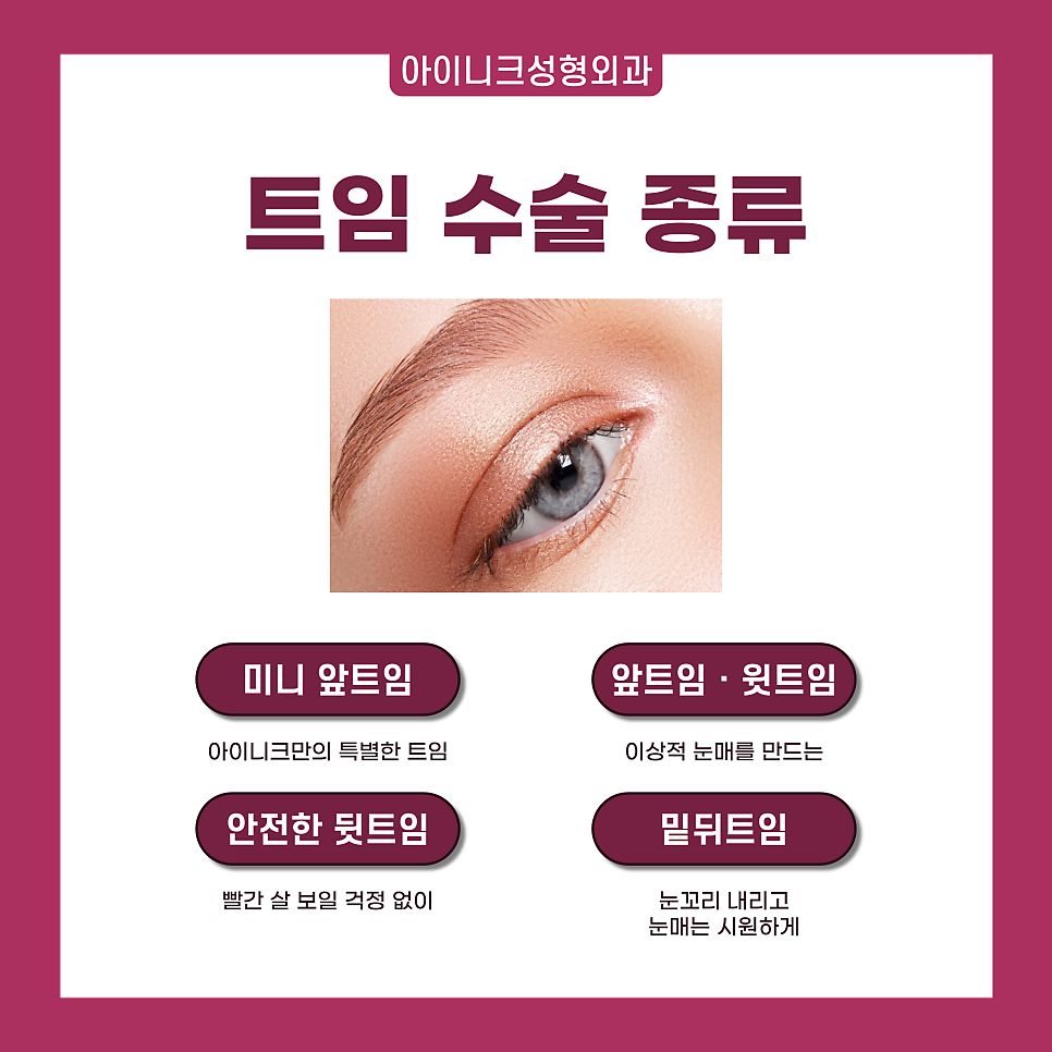 압구정 트임 수술 1위! 자연스럽고 확실한 인상 변화 관련 이미지 2