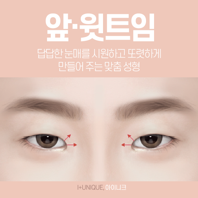 듀얼트임, 듀얼트임가격 한 번에 상담받기! 관련 이미지 2