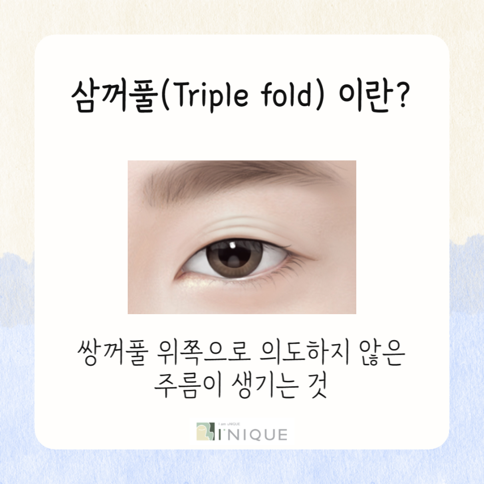 쌍꺼풀 겹주름 완벽하게 개선하는 법! 관련 이미지 2