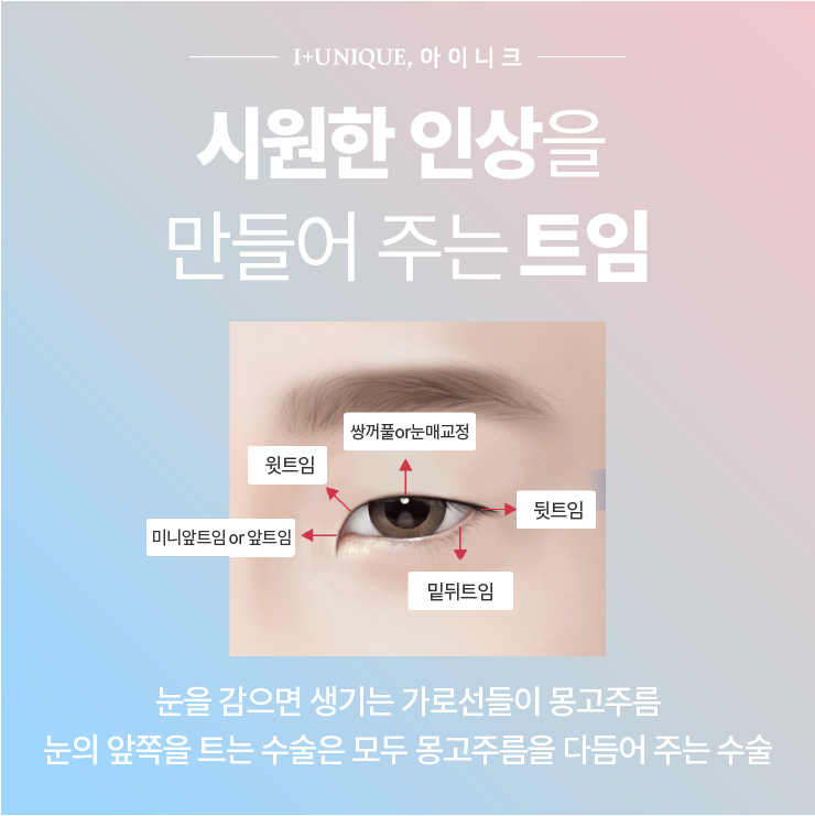 답답해 보이는 눈을 시원하게 트임! ㅇㅇㄴㅋ성형외과 관련 이미지 2