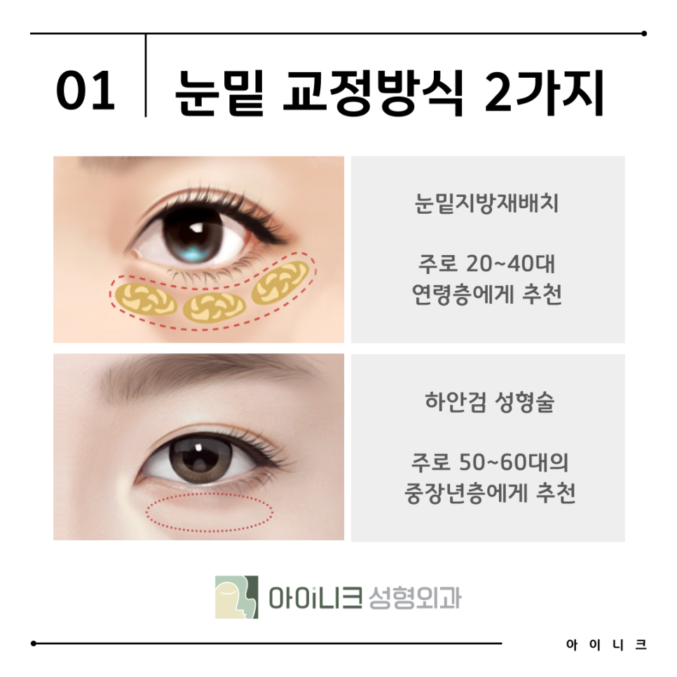 Recommended Hospital for Under-Eye Fat Repositioning: Finding the Right Method for Me image 6