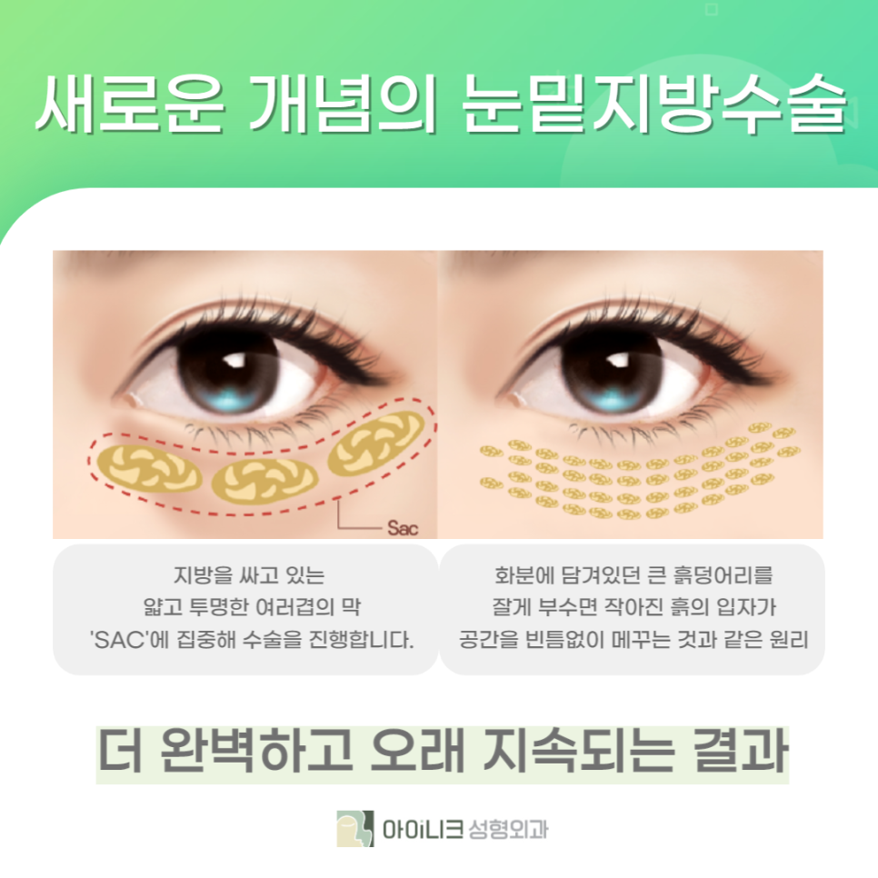 눈밑수술센터에서 더 환하고 밝은 눈 밑 만들기! 관련 이미지 2