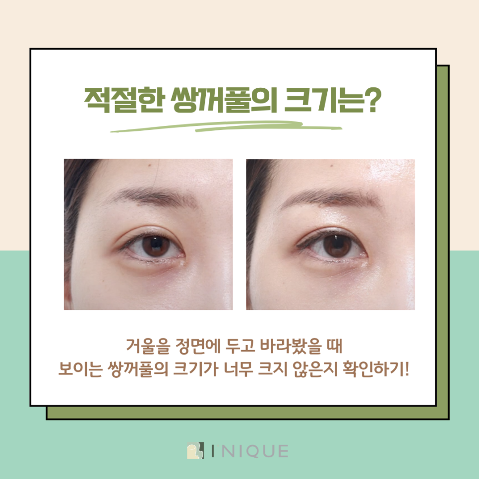 What Is the Solution for Unnatural Double Eyelids at a Place Known for Revision Eyelid Surgery in Apgujeong? image 5