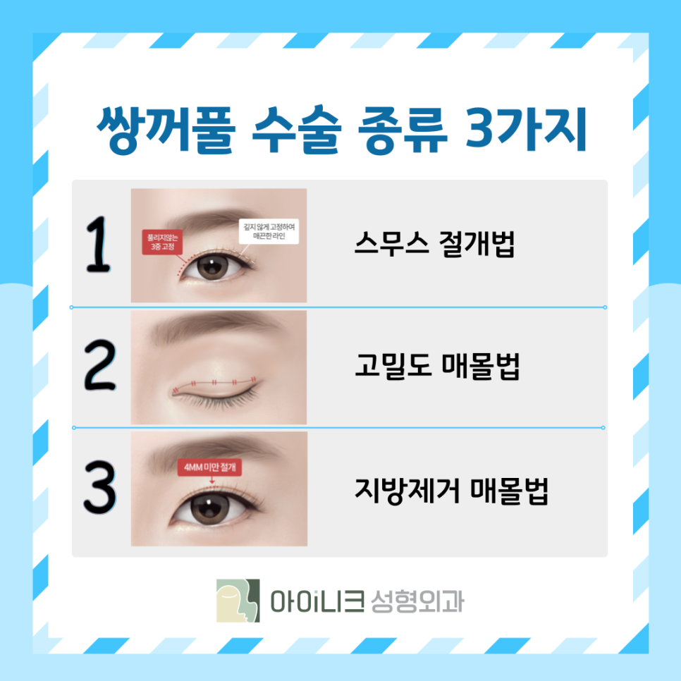 What Is the Right Choice Among Double Eyelid Surgery Types: Suture or Incisional? image 7