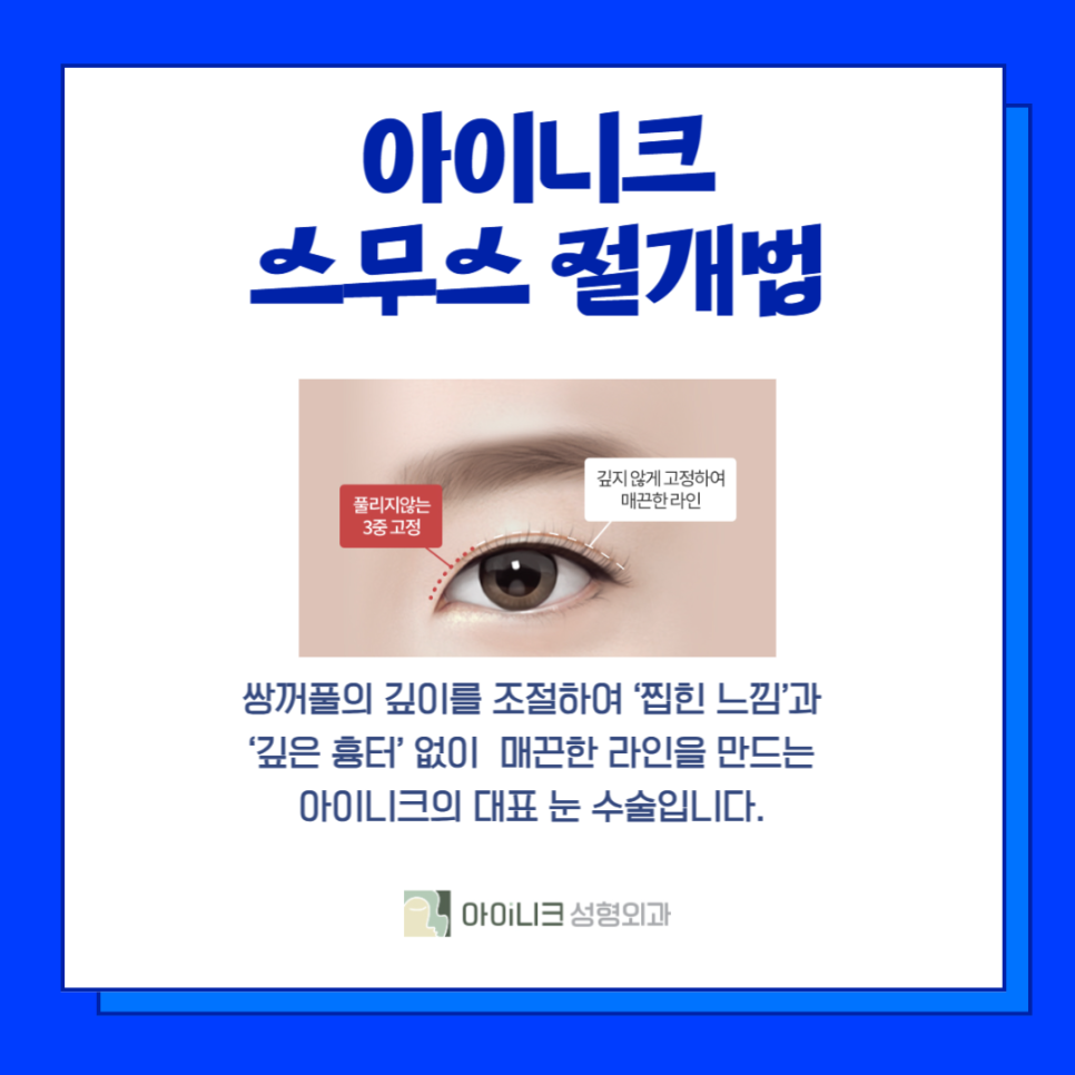서울쌍꺼풀수술 잘하는 곳 알려드려요! 관련 이미지 5