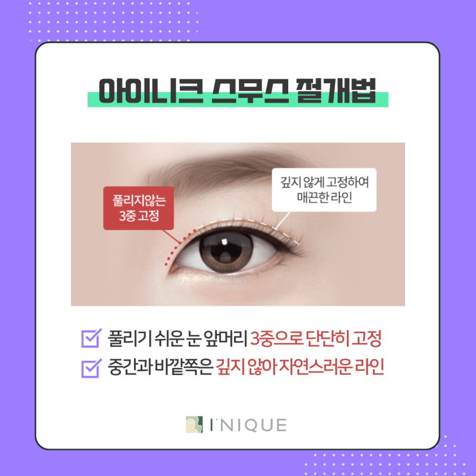 Apgujeong Double Eyelid Surgery Information! The Proper Way to Use Double Eyelid Tape image 6