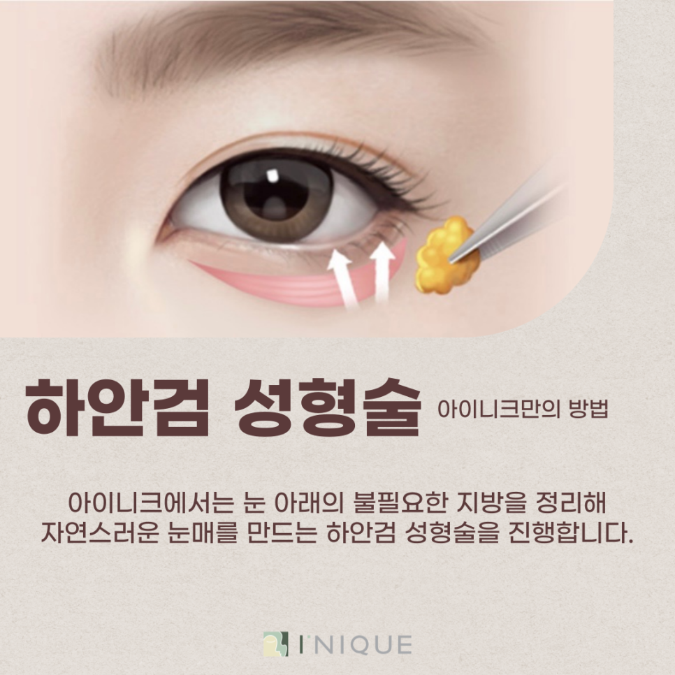 강남중년눈성형, 자신감의 비결 관련 이미지 6