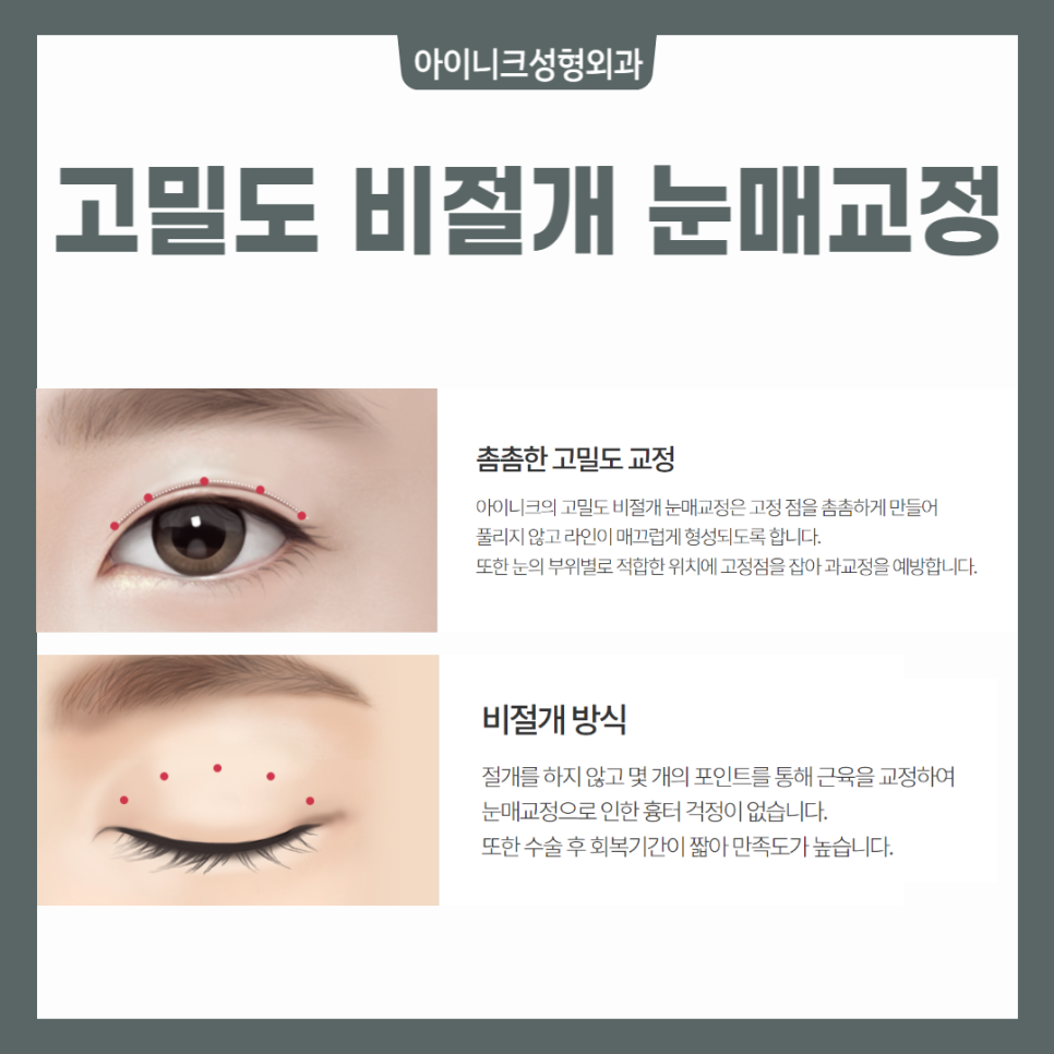 안검하수수술잘하는곳? 여기예요! 관련 이미지 5
