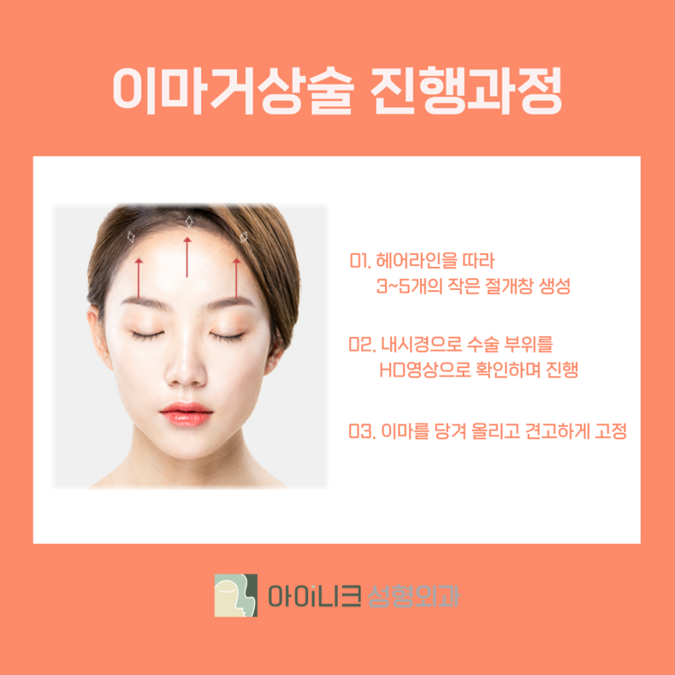 강남 이마거상 리프팅 노안 고민 해결하자 관련 이미지 6