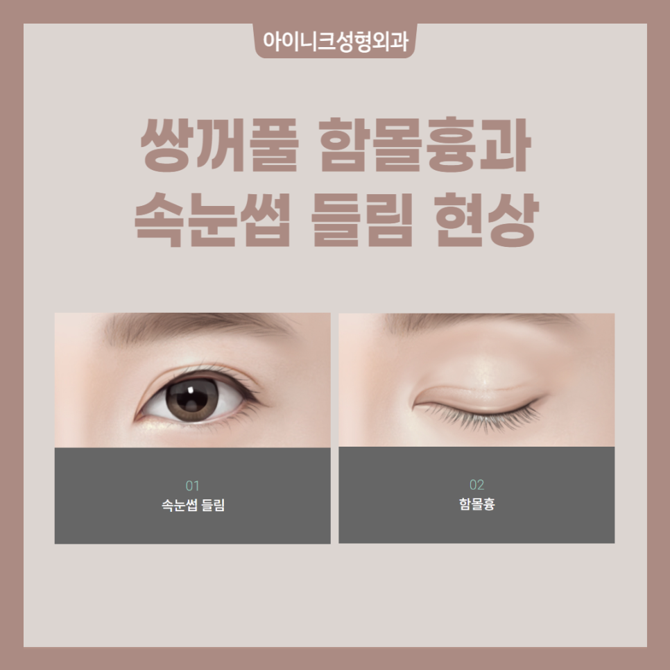 쌍꺼풀 흉터 원인과 해결 방법 관련 이미지 2
