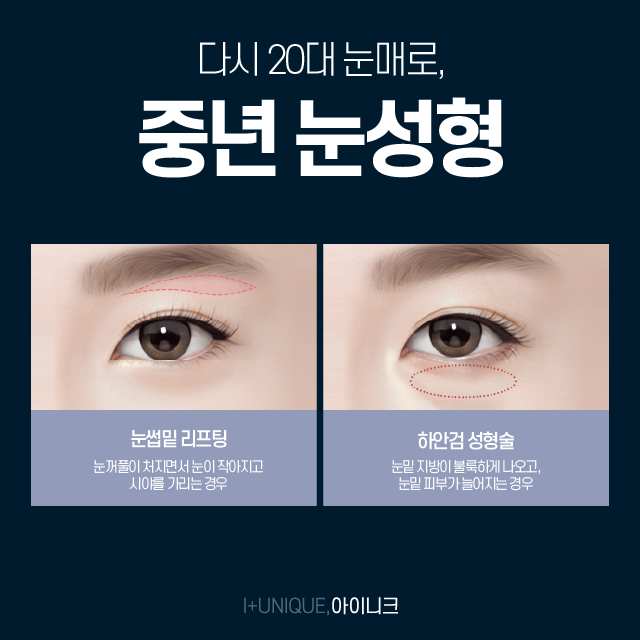 중년눈매교정 자연스러운 아름다움이 가장 좋습니다. 관련 이미지 2