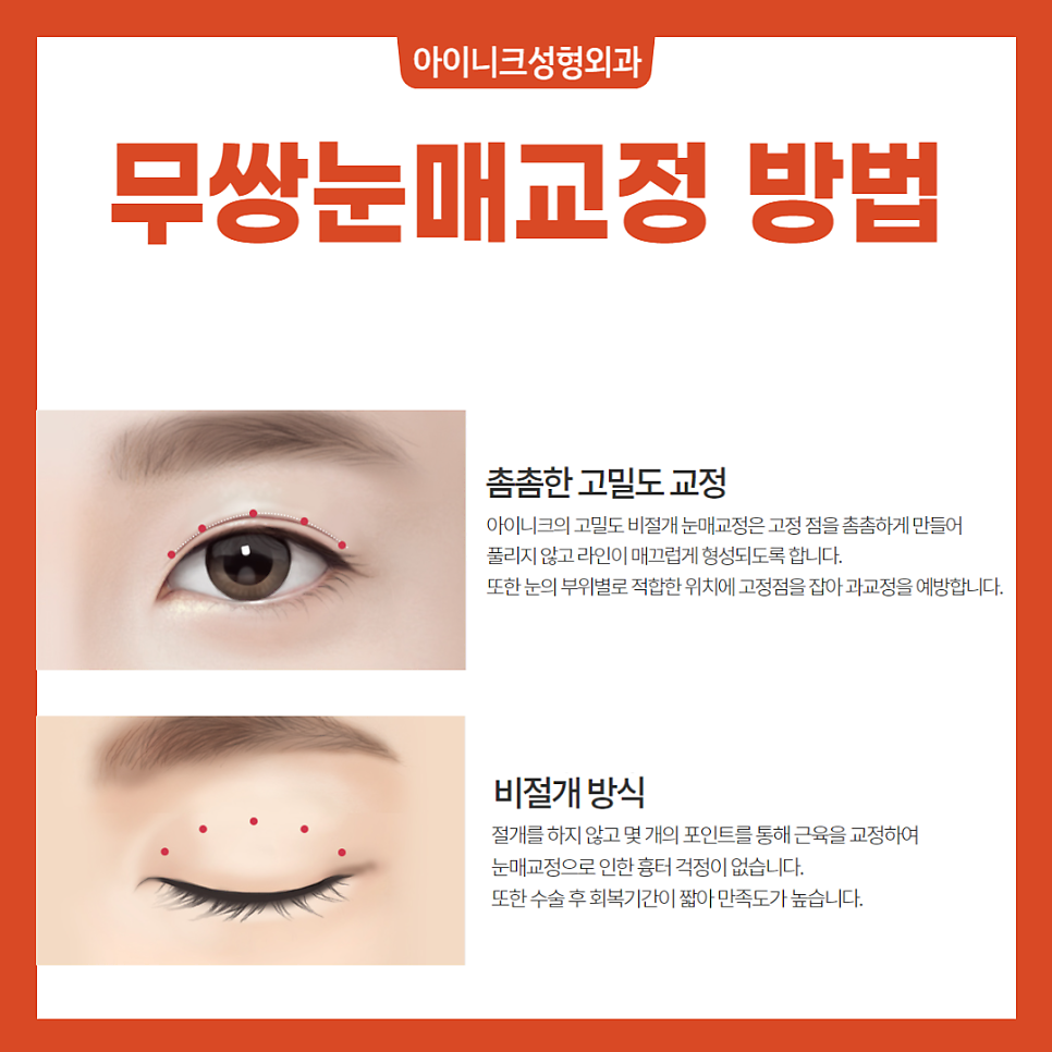 남자쌍수가격 보다 더 중요한 이것 관련 이미지 5
