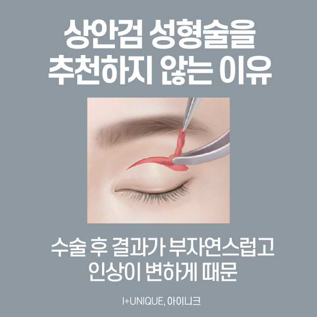 효도성형, 안전하게 해야죠! 관련 이미지 4