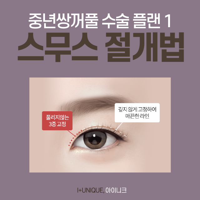중년 눈 성형? 쌍꺼풀보다 눈썹 밑 리프팅, 하안검 수술 추천 관련 이미지 2